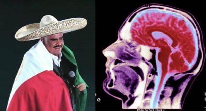 ¿Qué es MUERTE cerebral? El diagnóstico LETAL que "envolvió" a Vicente Fernández