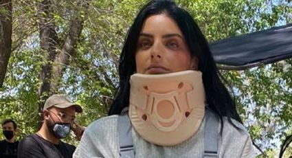 ¡Qué le pasó! Aislinn Derbez aparece con múltiples heridas en una FOTO y aclara su estado de salud