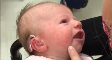 ¡Qué tierno! Bebé SORDA escucha a su MAMÁ por primera vez y su reacción se hace viral: VIDEO