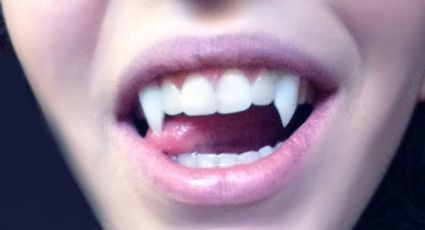 ¡Cuidado! La terrorífica tendencia de afilar tus dientes, "PUDRE" tu boca: VIDEO