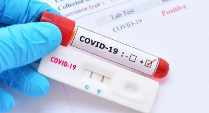 ¿Prueba de sangre es una alternativa a la PCR para detectar casos COVID? Acá te contamos