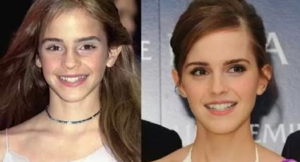 Emma Watson: El antes y después de la estrella de “Harry Potter” en su cumpleaños 32