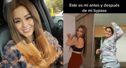 Gomita: el antes y después tras perder 13 kilos, este es su impactante cambio: FOTOS