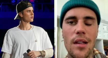 Justin Bieber confirma que padece el síndrome de Ramsay Hunt; ¿qué es y de que se trata?