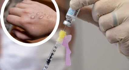 FDA aprueba nuevo método de vacunación que aumentará hasta cinco veces las dosis disponibles