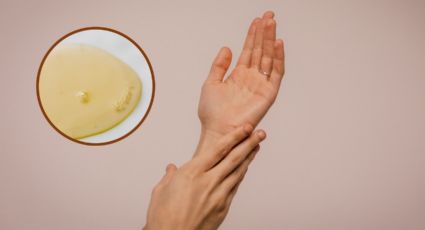 Cómo QUITAR las manchas de las manos con aceite de almendras en menos de 15 días