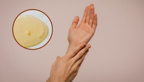 Cómo QUITAR las manchas de las manos con aceite de almendras en menos de 15 días