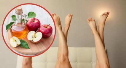 Remedio casero con vinagre de manzana para piernas perfectas, lisas, suaves y sin granitos