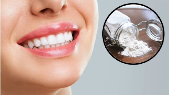 Remedios caseros para blanquear los dientes de forma natural y tener una sonrisa bonita