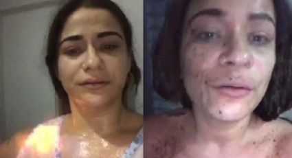 Mujer se prende fuego después de que su pareja no le perdonara una infidelidad: VIDEO VIRAL