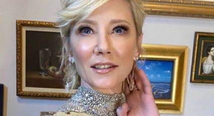 Anne Heche: Pese a estar en coma, la investigan por delito grave tras chocar contra una casa