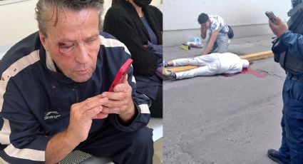 ¡Sí fue real! Alfredo Adame es involucrado en persecución policíaca y recibe fuertes golpes: FOTO