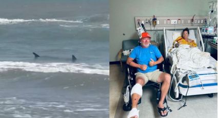 Mujer que fue mordida por tiburón en Texas revela si perderá la pierna en desgarrador VIDEO